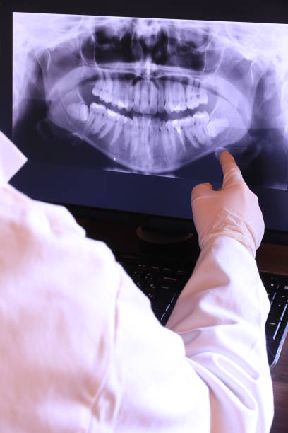 Best Emergency Denture Repair in Lawndale, CA
